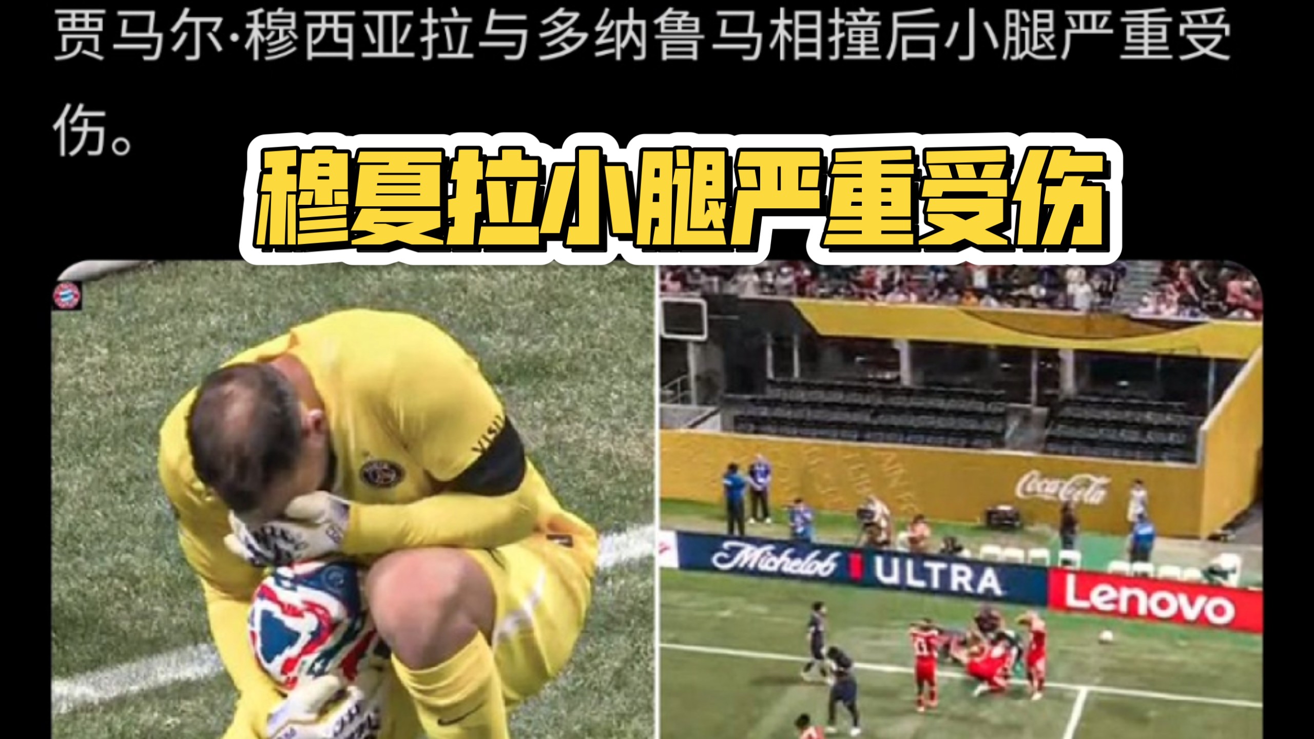 拜仁慕尼黑阵中重要球员因伤缺席的简单介绍 拜仁慕尼黑阵中重要球员因伤缺席的简单介绍